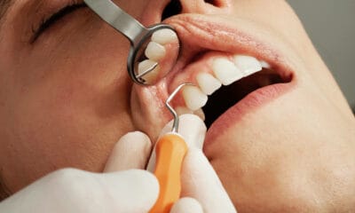 coroane dentare sorina stroe medic 2